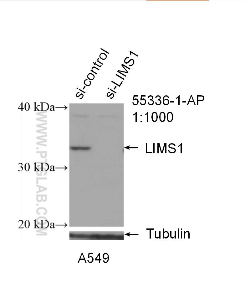 LIMS1