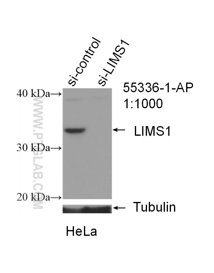 WB analysis of HeLa using 55336-1-AP (same clone as 55336-1-PBS)