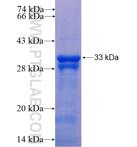 LIMS1 fusion protein Ag14956 SDS-PAGE LIMS1 fusion protein Ag14956 SDS-PAGE