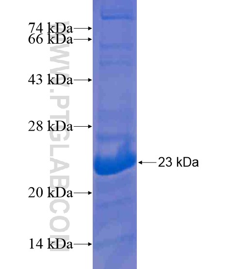 LIN28B fusion protein Ag21266 SDS-PAGE LIN28B fusion protein Ag21266 SDS-PAGE