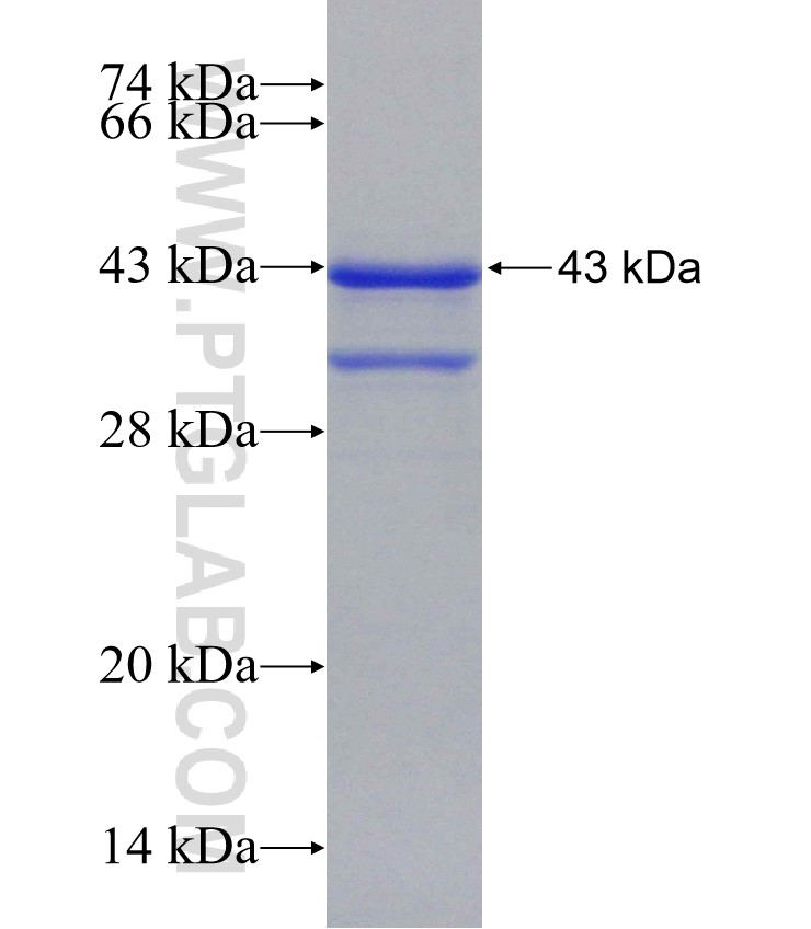 LIN28B fusion protein Ag21241 SDS-PAGE