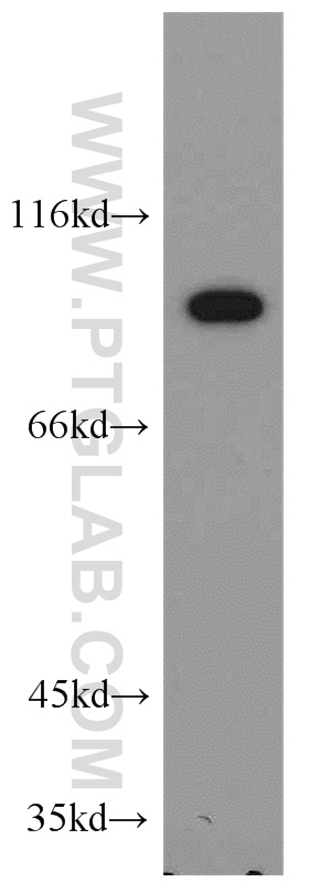 WB analysis of mouse kidney using 55003-1-AP