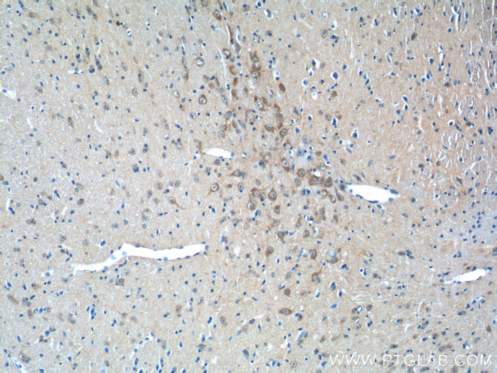 IHC staining of mouse brain using 25150-1-AP