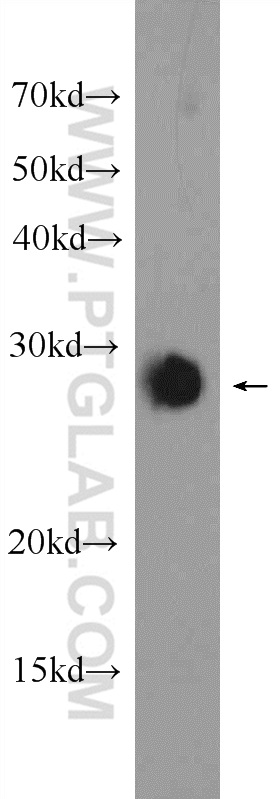 WB analysis of rat brain using 25150-1-AP