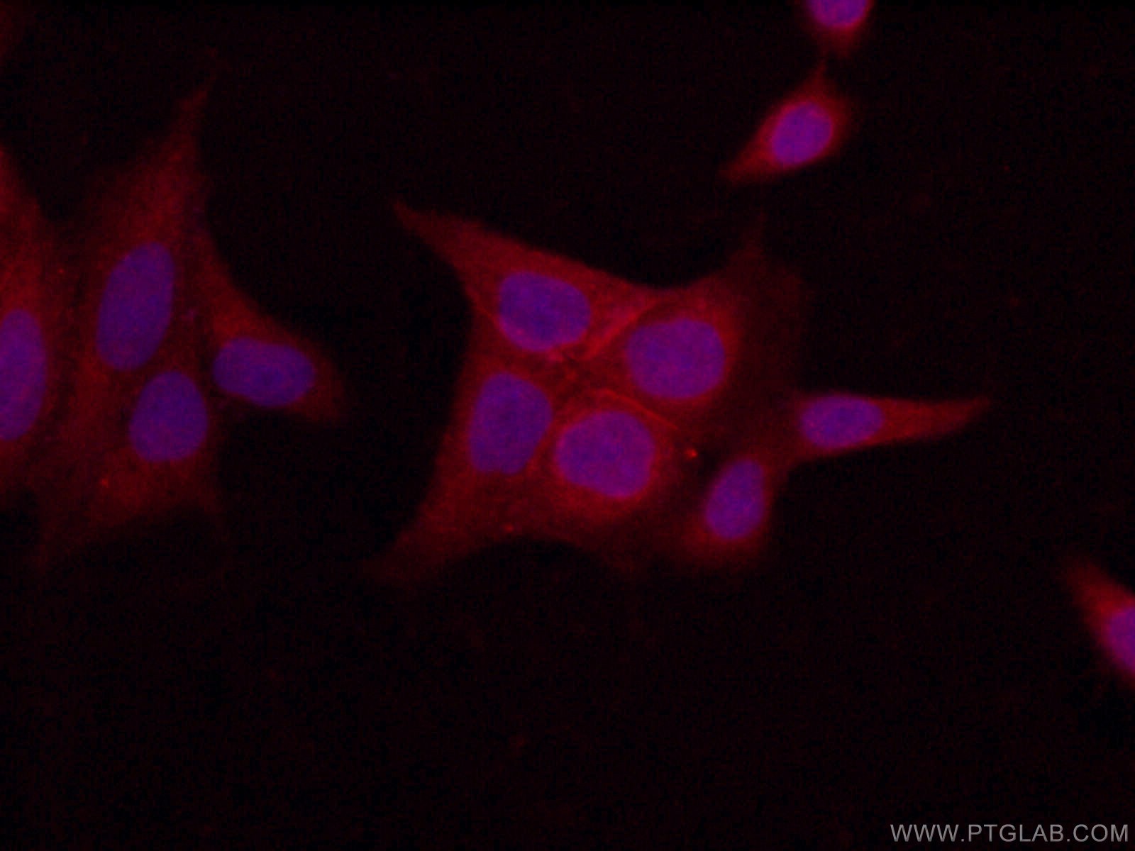 IF Staining of HeLa using 14656-1-AP