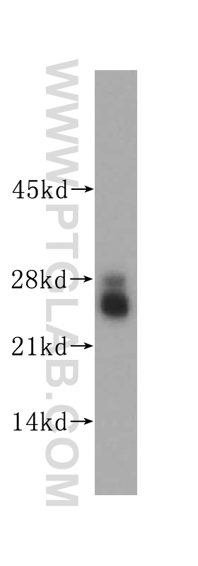 WB analysis of human cerebellum using 14656-1-AP