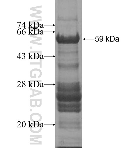 LIN9 fusion protein Ag11889 SDS-PAGE