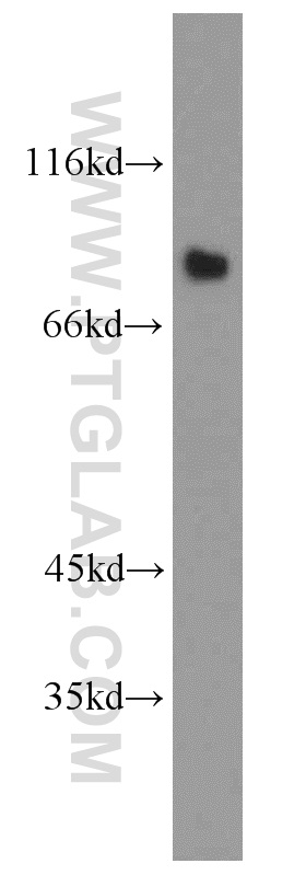 LINGO1 Polyclonal antibody