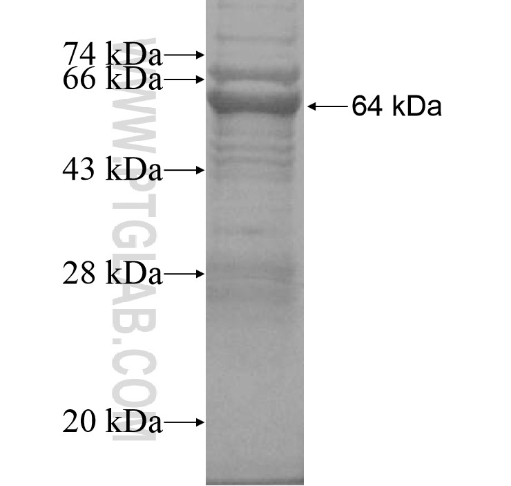 LINGO4 fusion protein Ag16231 SDS-PAGE LINGO4 fusion protein Ag16231 SDS-PAGE