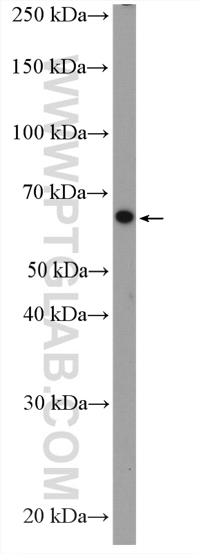 WB analysis of HepG2 using 21133-1-AP