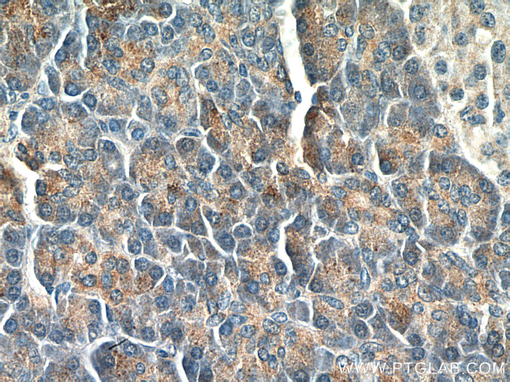 IHC staining of human pancreas using 66303-1-Ig (same clone as 66303-1-PBS)