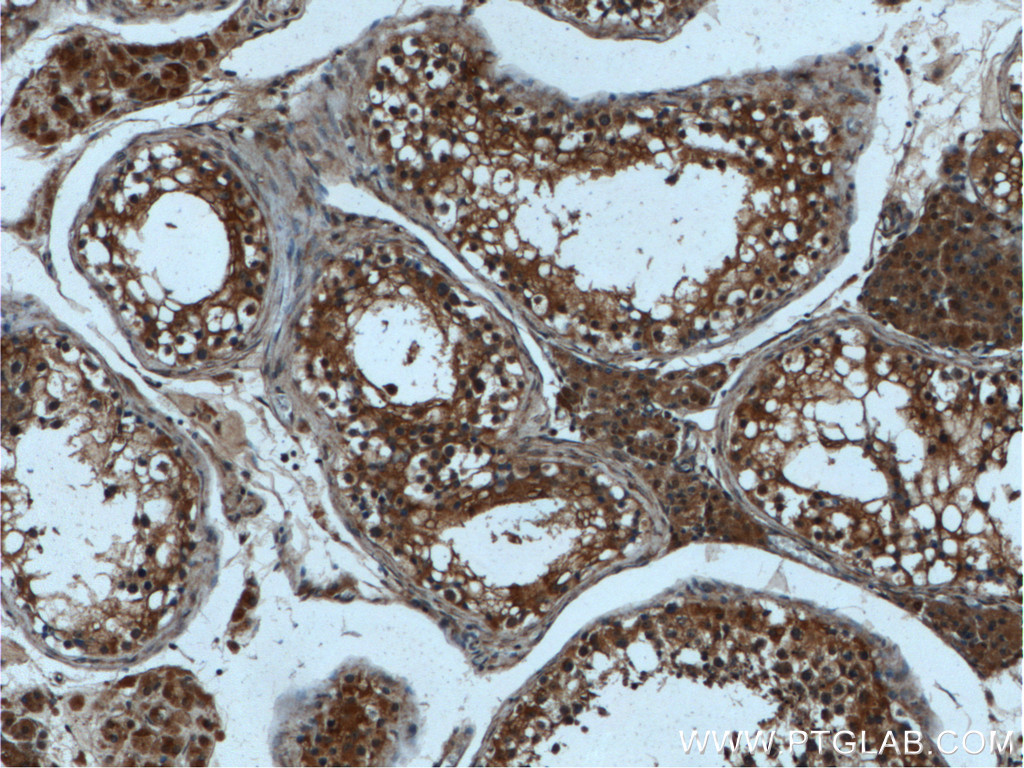 IHC staining of human testis using 24300-1-AP