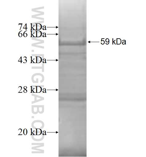 LIPT1 fusion protein Ag8774 SDS-PAGE