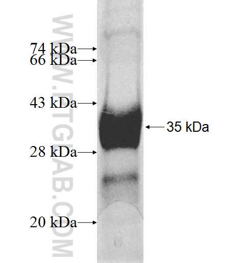 LIPT1 fusion protein Ag8825 SDS-PAGE LIPT1 fusion protein Ag8825 SDS-PAGE