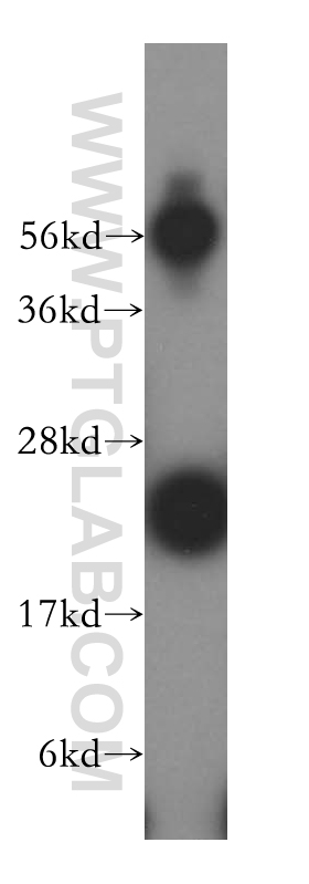 WB analysis of HeLa using 16797-1-AP