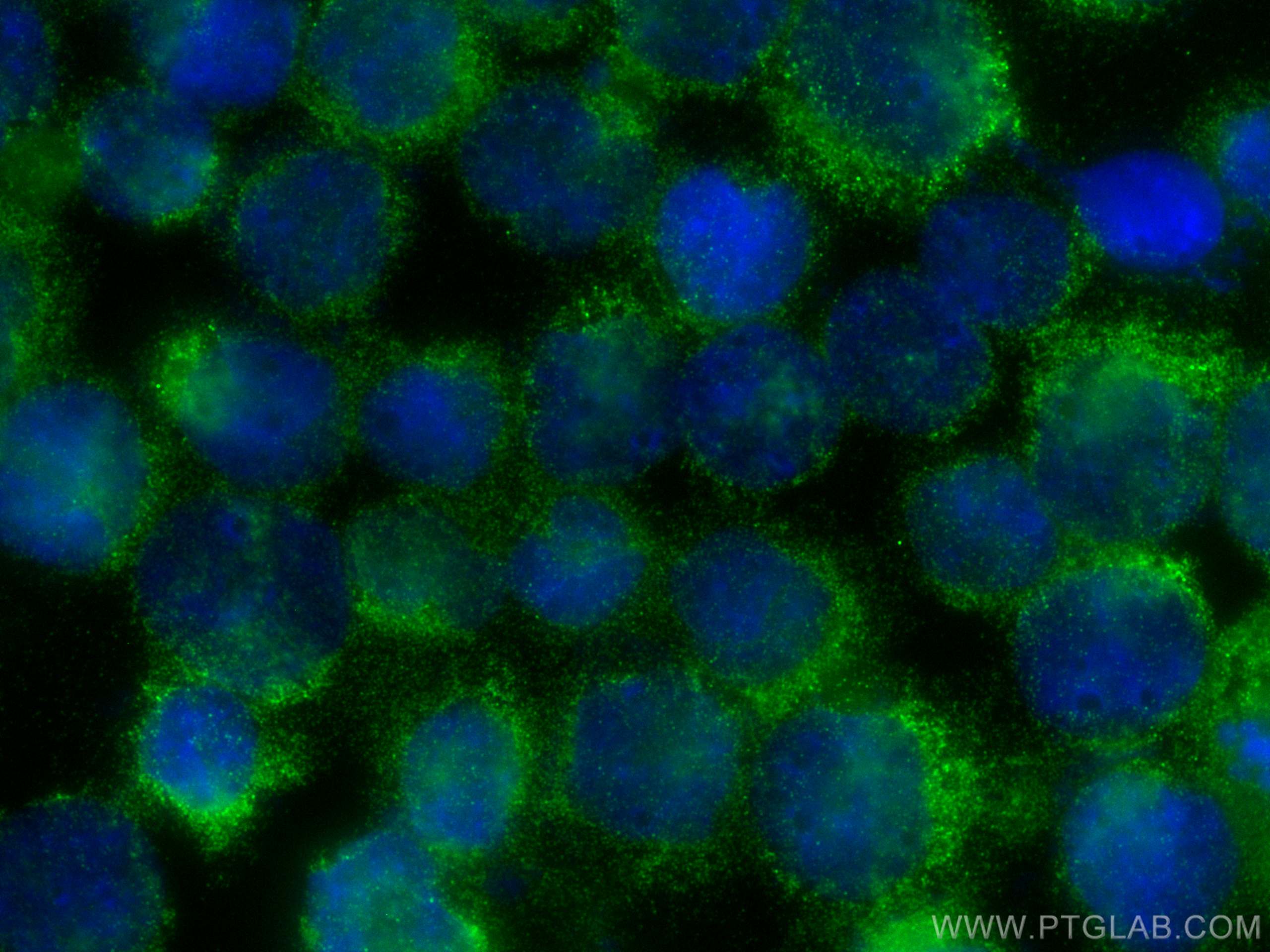 IF Staining of K-562 using 25557-1-AP