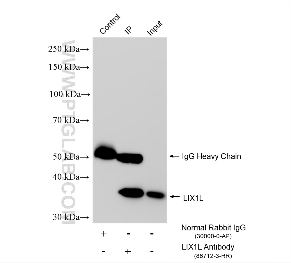 IP experiment of Jurkat using 86712-3-RR (same clone as 86712-3-PBS)
