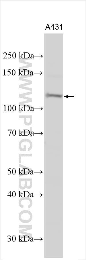 WB analysis using 22496-1-AP