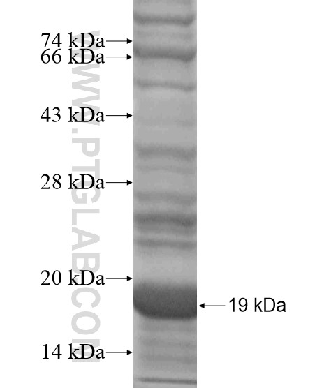 LLGL1 fusion protein Ag19066 SDS-PAGE LLGL1 fusion protein Ag19066 SDS-PAGE