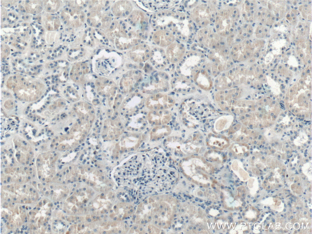 IHC staining of human kidney using 17877-1-AP