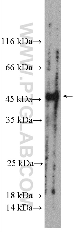 WB analysis of mouse small intestine using 27203-1-AP