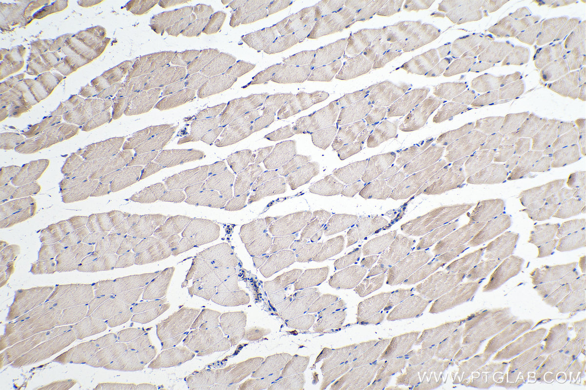 IHC staining of mouse skeletal muscle using 67834-1-Ig