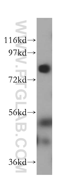 WB analysis of HeLa using 16249-1-AP