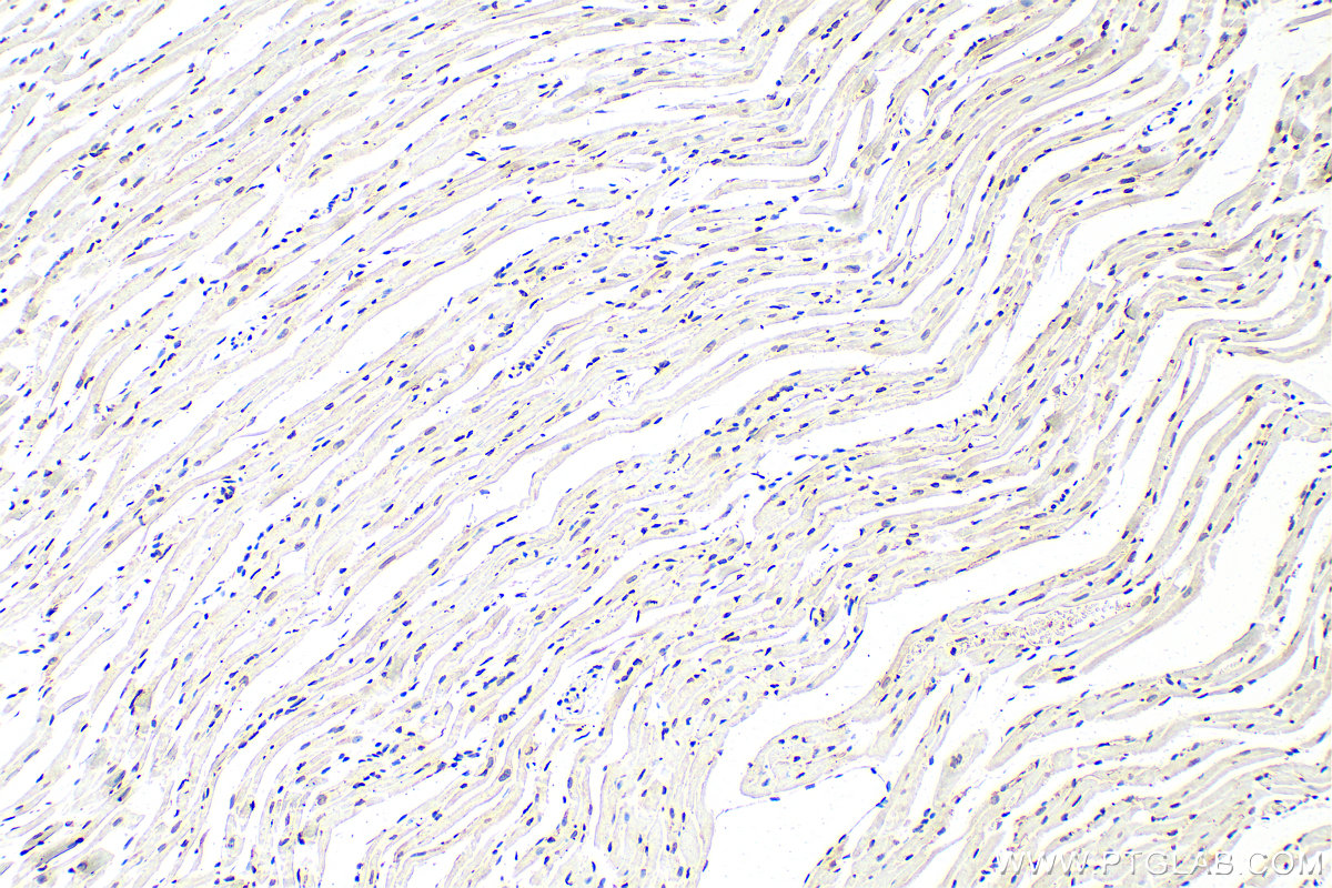 IHC staining of mouse heart using 12987-1-AP