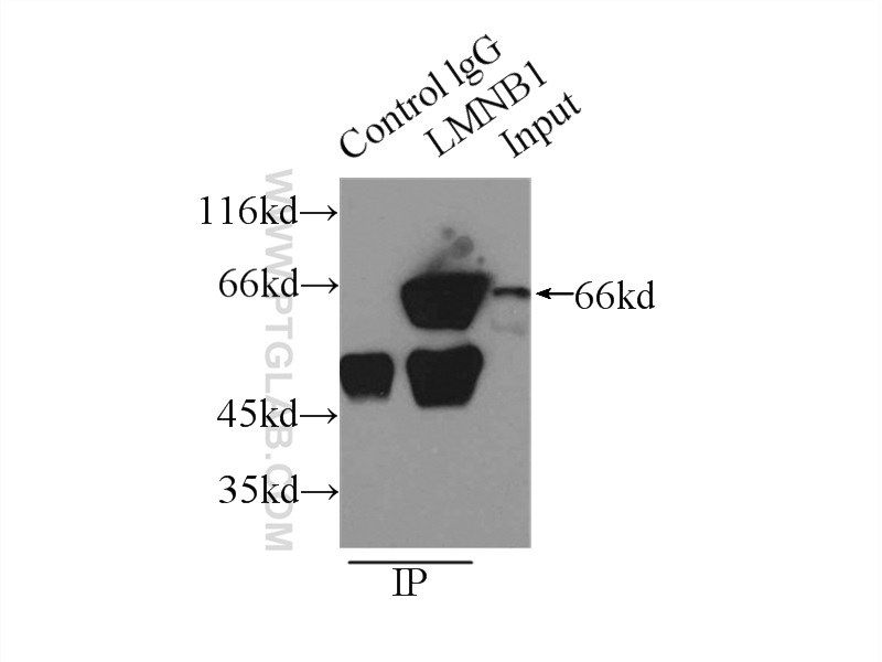 IP experiment of HeLa using 12987-1-AP