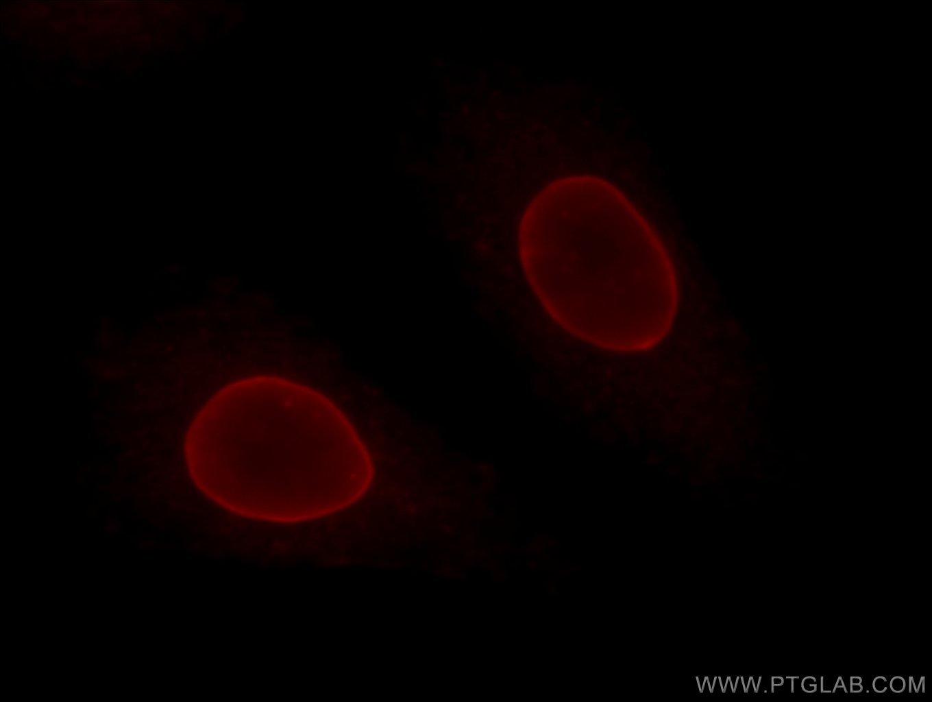 Lamin B1 Monoclonal antibody