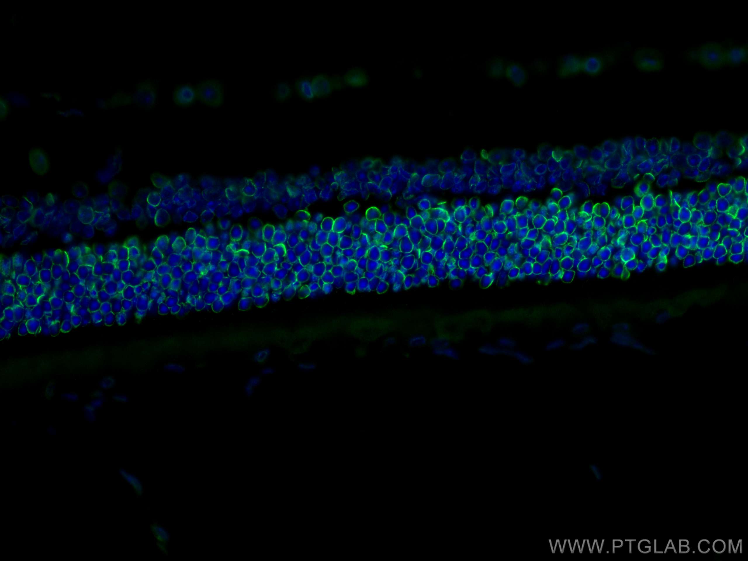 IF Staining of mouse eye using 66095-1-Ig (same clone as 66095-1-PBS)