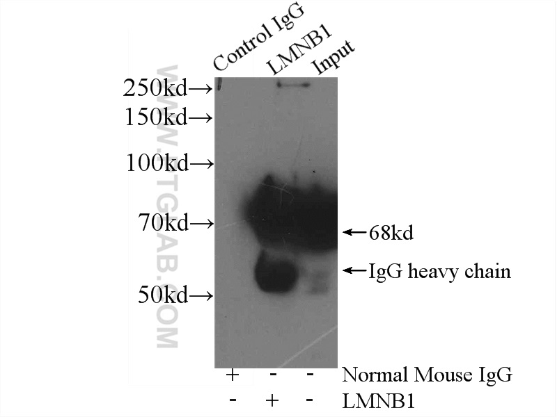 IP experiment of HeLa using 66095-1-Ig