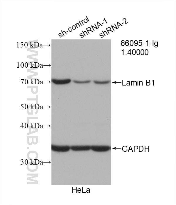 WB analysis of HeLa using 66095-1-Ig (same clone as 66095-1-PBS)