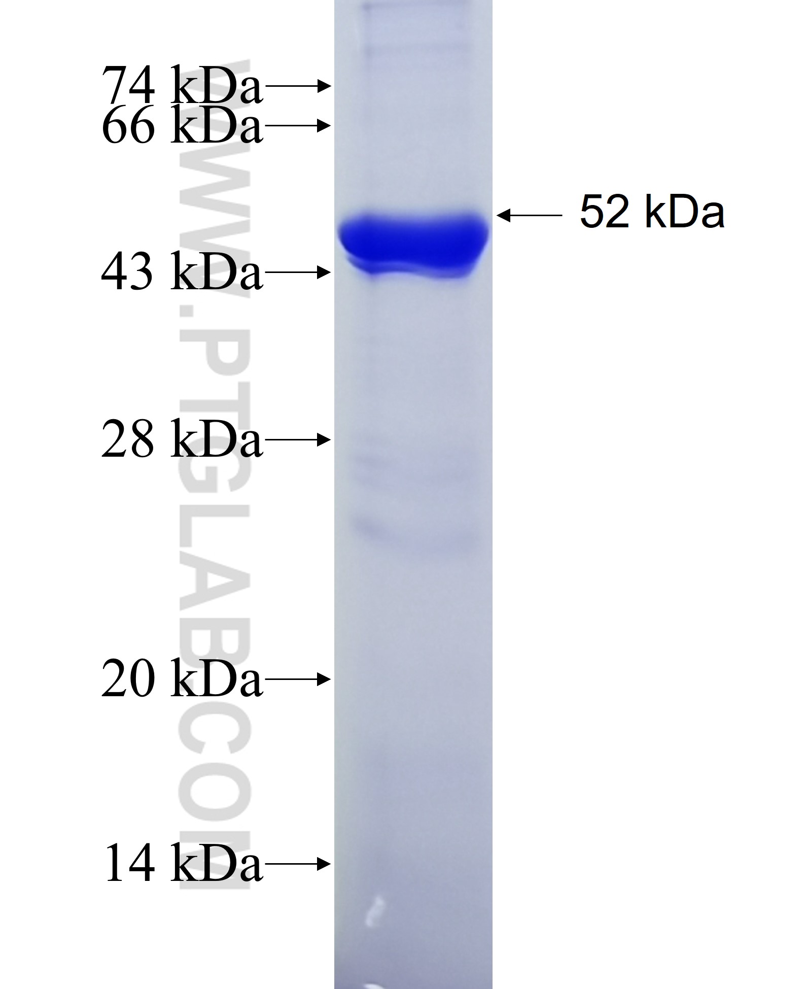 Lamin B1 fusion protein Ag20522 SDS-PAGE