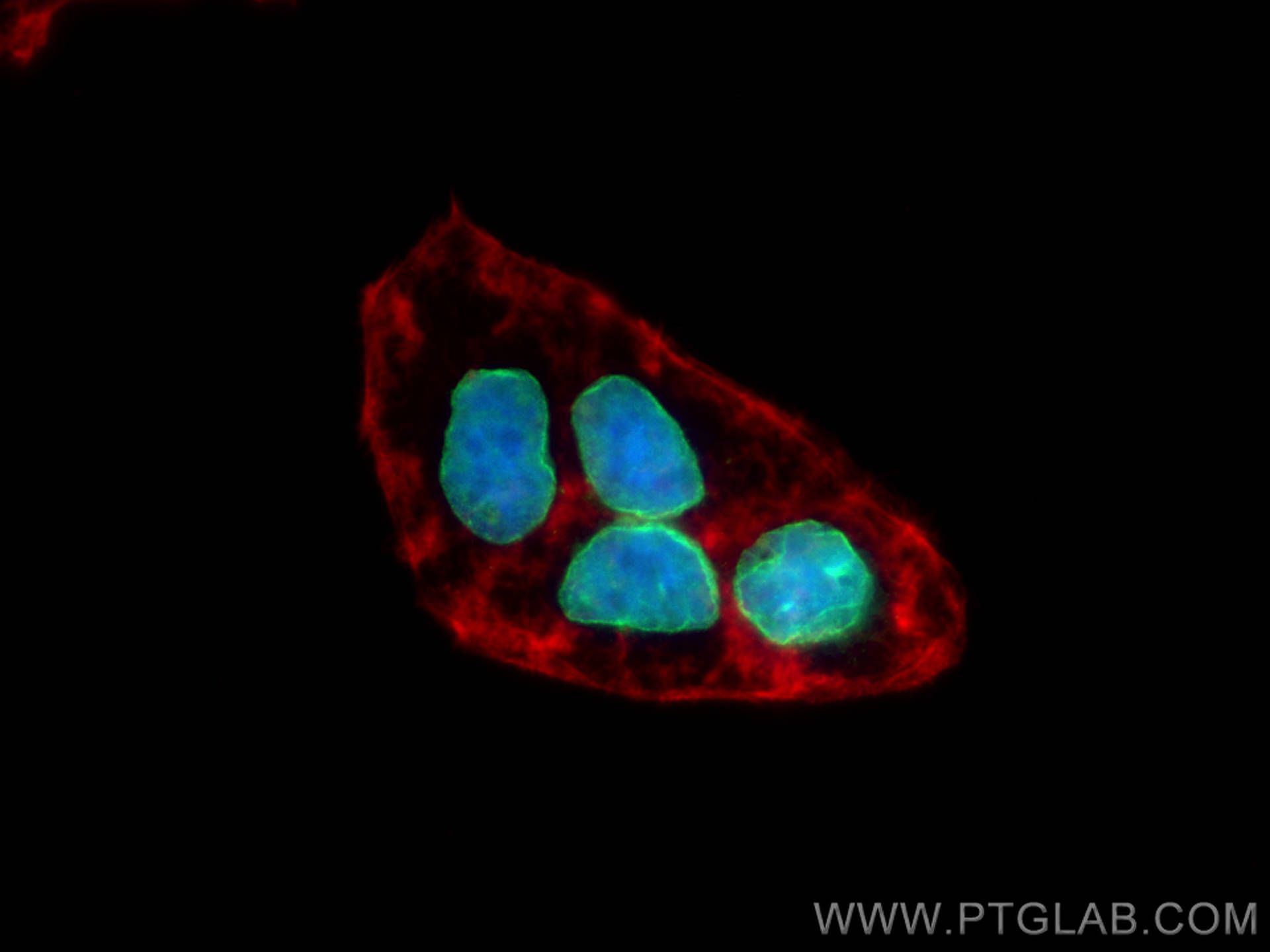 IF Staining of Caco-2 using 10895-1-AP