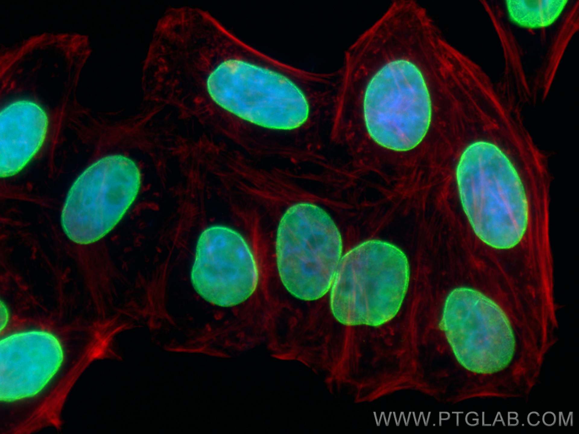 IF Staining of HepG2 using 82801-3-RR (same clone as 82801-3-PBS)