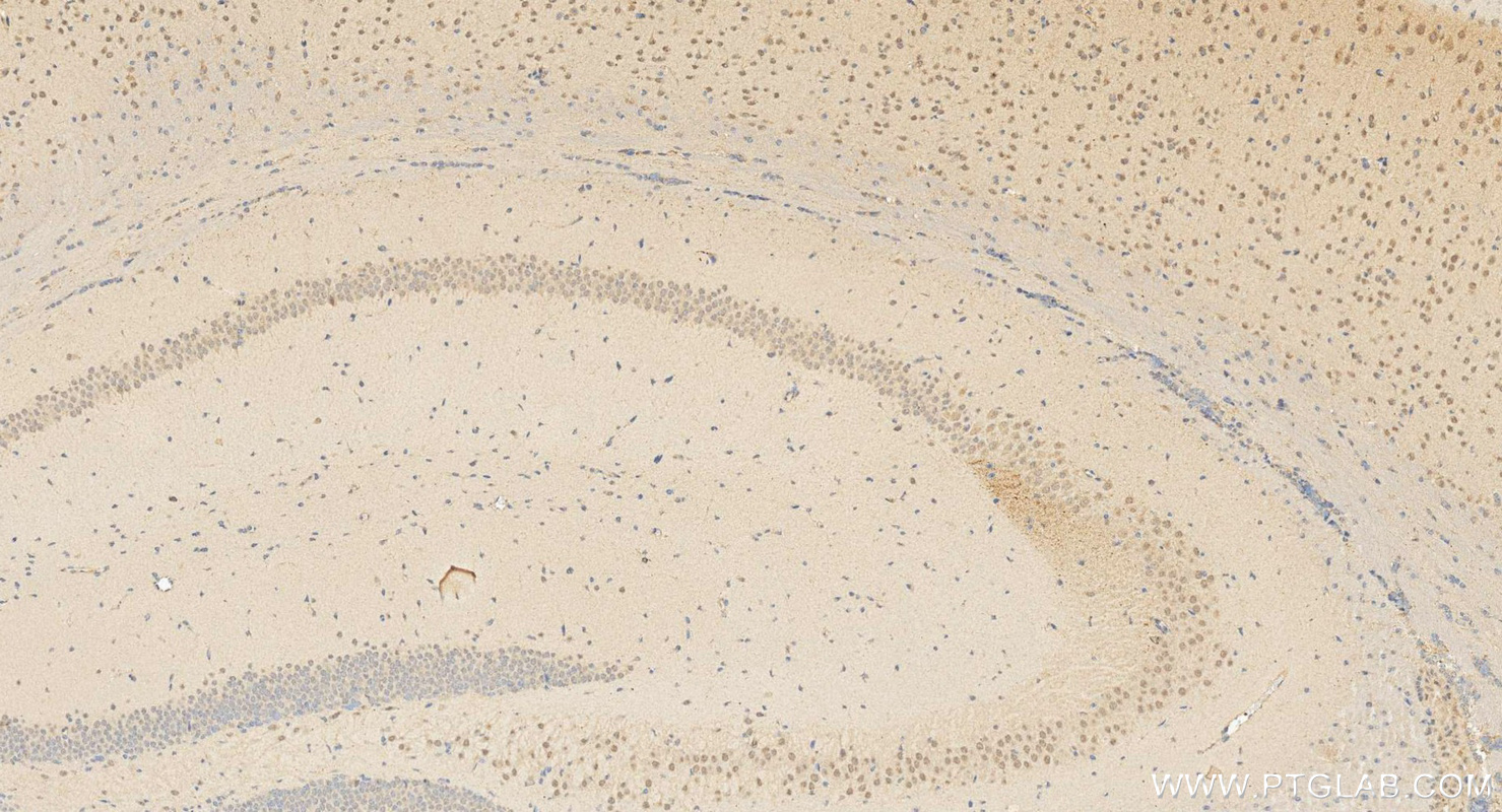 IHC staining of mouse brain using 12146-1-AP