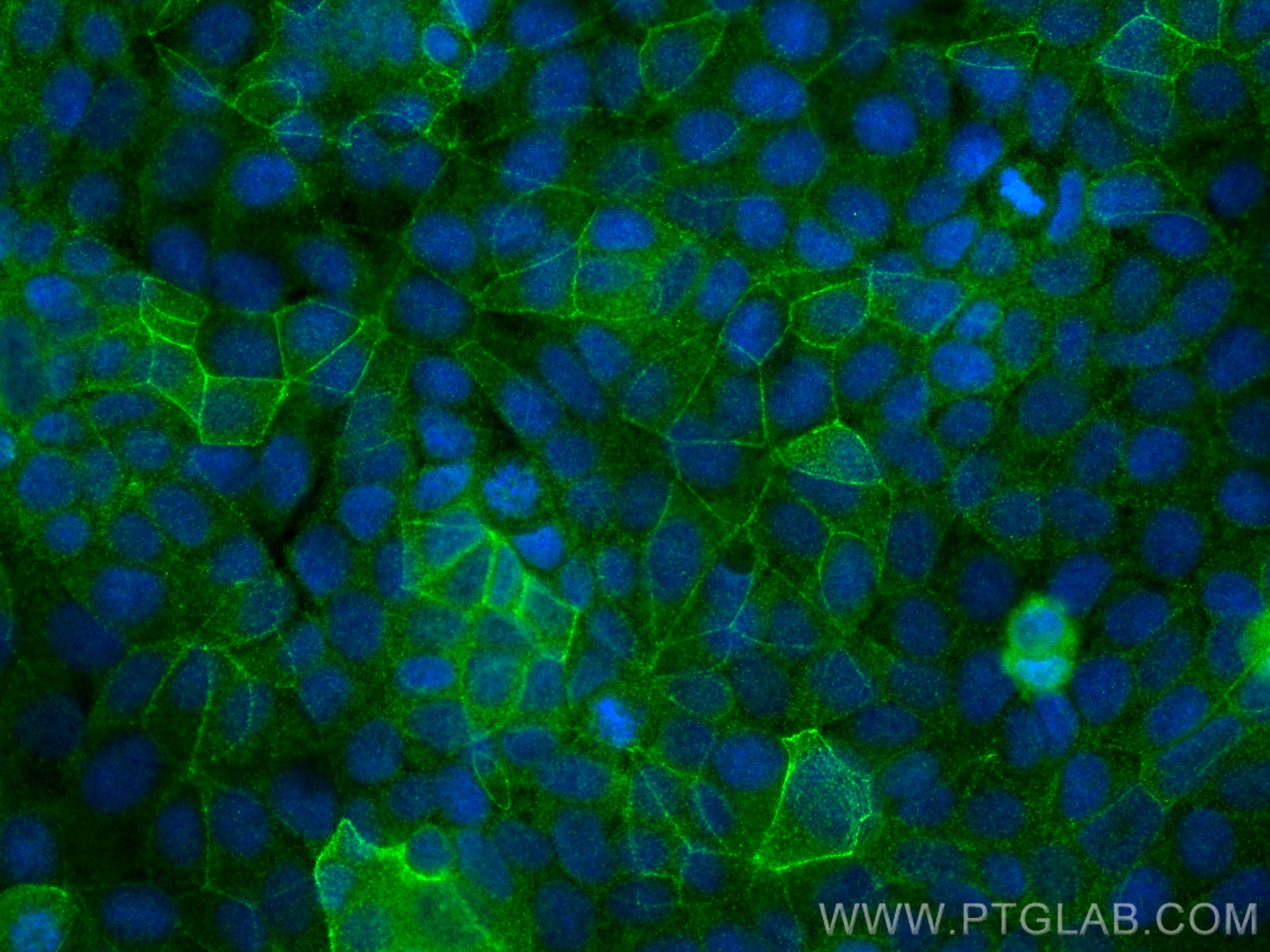 IF Staining of MCF-7 using 29392-1-AP