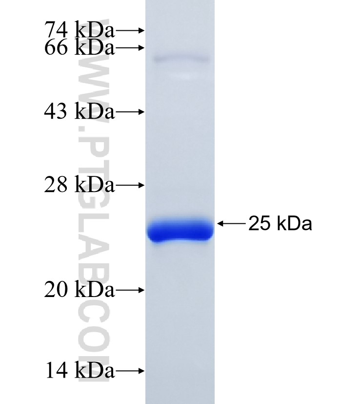 LMOD2 fusion protein Ag35362 SDS-PAGE