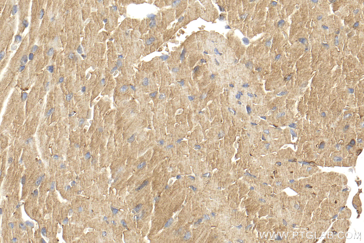 IHC staining of mouse heart using 14948-1-AP