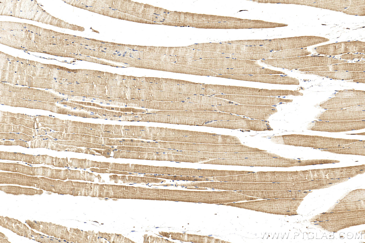 IHC staining of mouse skeletal muscle using 14948-1-AP