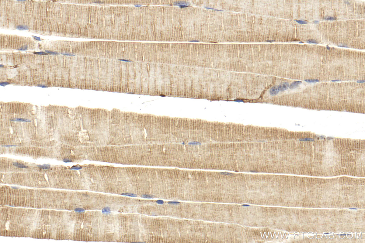 IHC staining of mouse skeletal muscle using 14948-1-AP