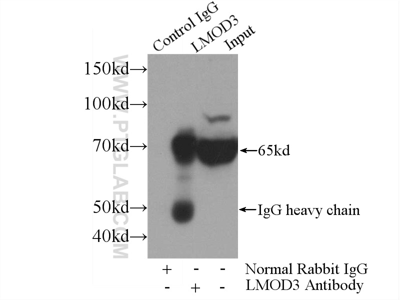 IP experiment of mouse skeletal muscle using 14948-1-AP