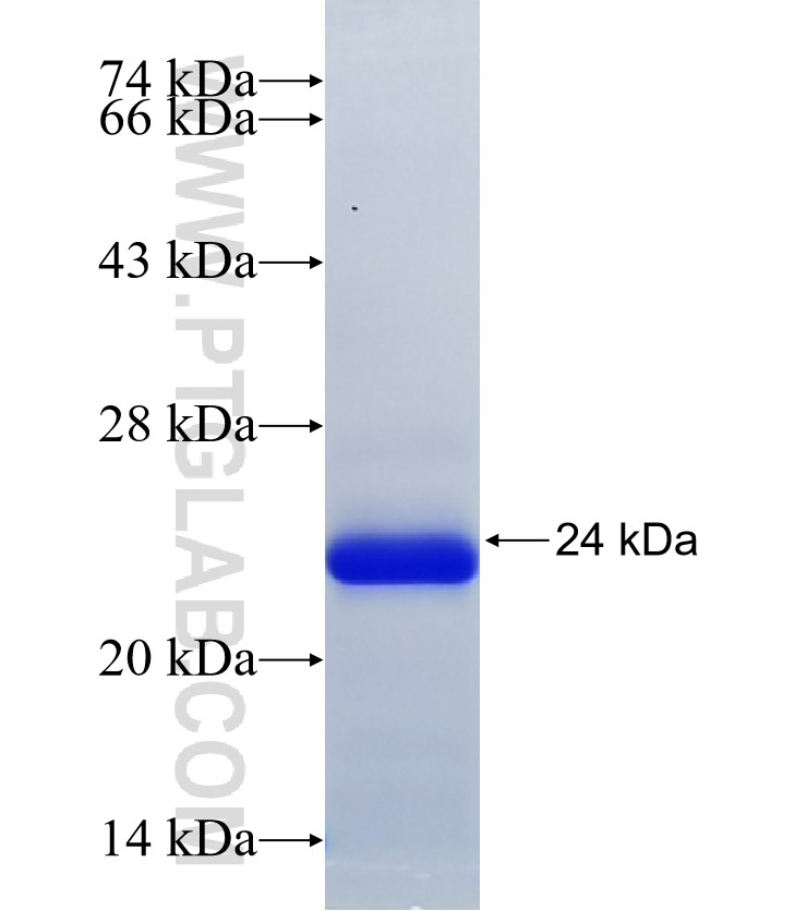 LMTK2 fusion protein Ag35493 SDS-PAGE LMTK2 fusion protein Ag35493 SDS-PAGE