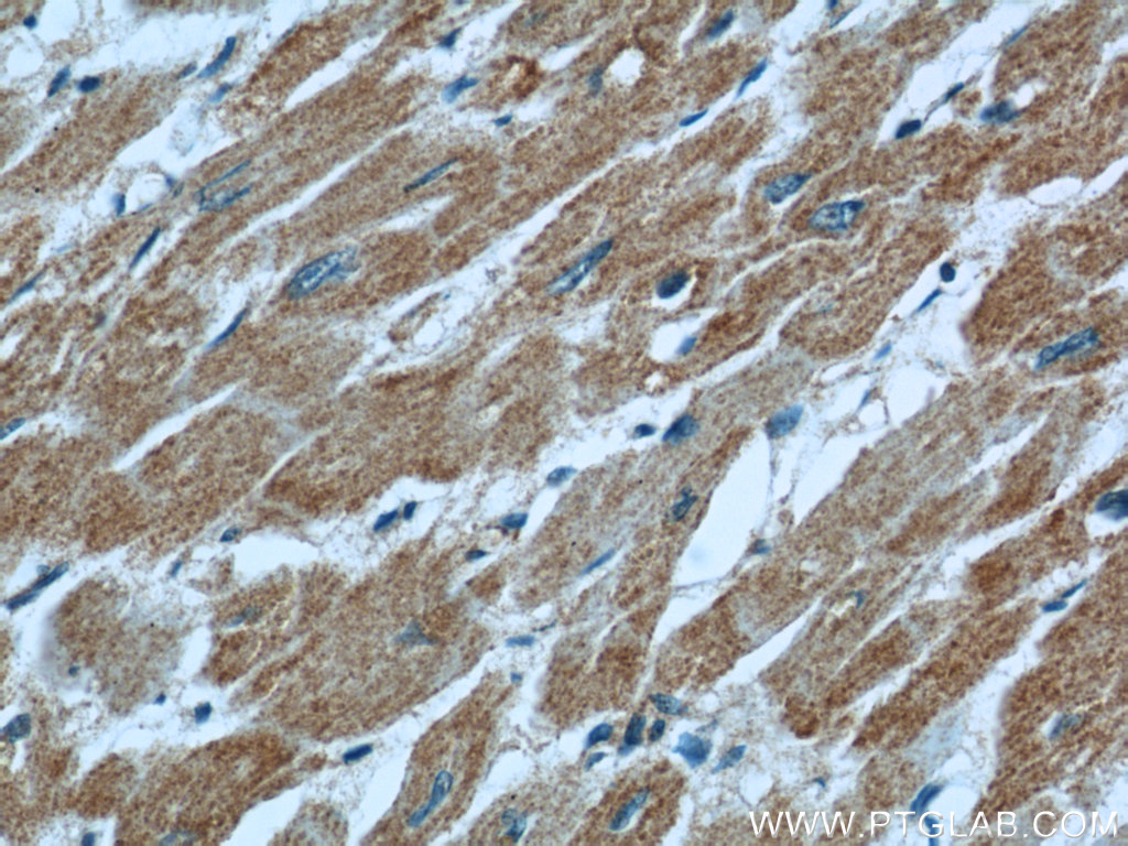 IHC staining of human heart using 55154-1-AP
