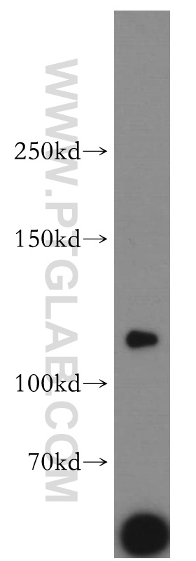 WB analysis of human brain using 55154-1-AP