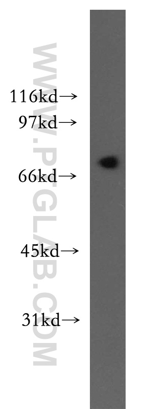 WB analysis of mouse testis using 13124-1-AP