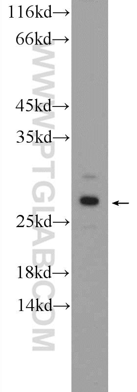 WB analysis of mouse liver using 26070-1-AP