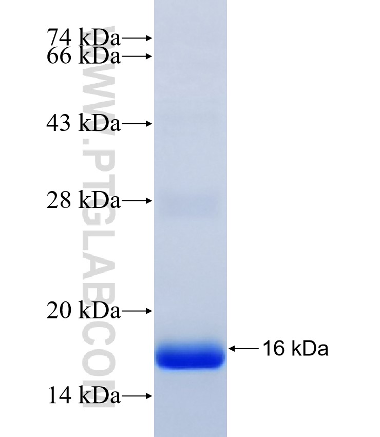 LOC284297 fusion protein Ag37422 SDS-PAGE LOC284297 fusion protein Ag37422 SDS-PAGE