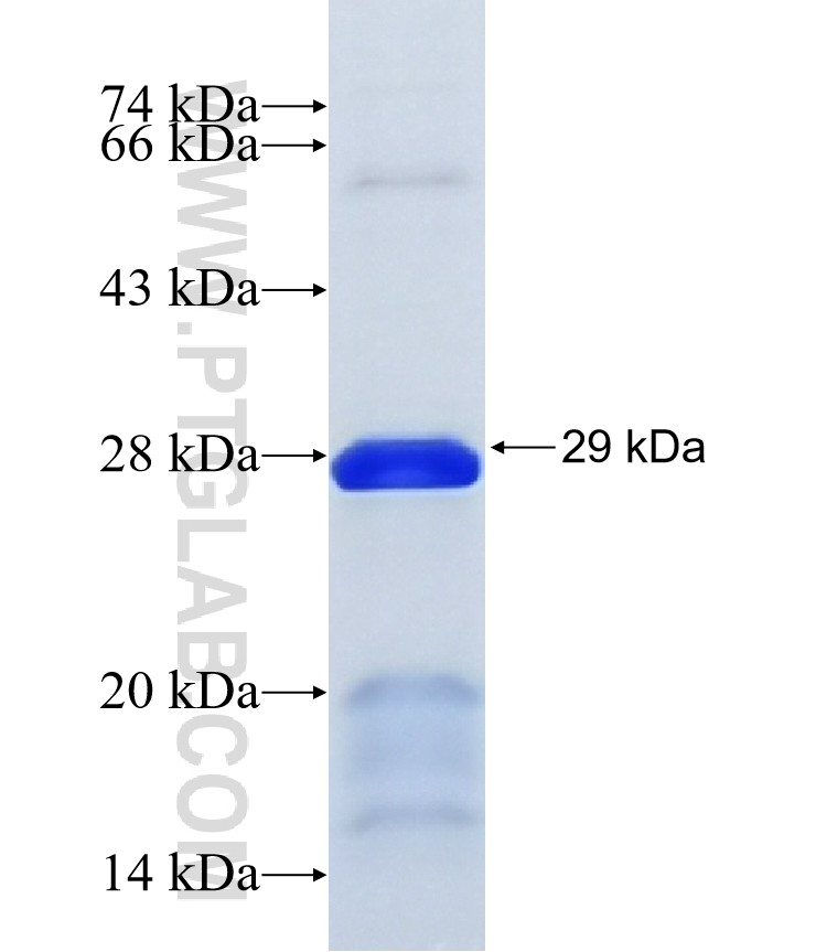 LOC284805 fusion protein Ag34401 SDS-PAGE LOC284805 fusion protein Ag34401 SDS-PAGE